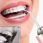 Oral-hygiene-water-flosser.webp